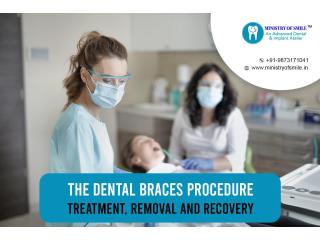 Best Dental Care Experience in Gurgaon