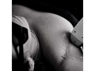 Smooth Skin Solutions Through Laser Hair Removal Vaughan