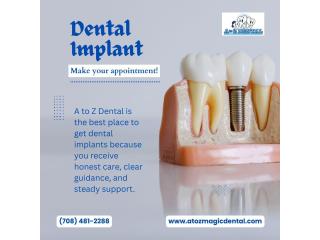 A to Z Dental: Best Place to Get Dental Implants