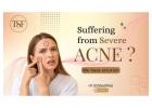 Best Skin Specialist & Dermatologist in Pune - The Skin Firm 