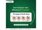 Effective Root Canal Treatment in Noida
