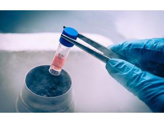 Fertility Preservation in Delhi - Dr Rhythm Gupta