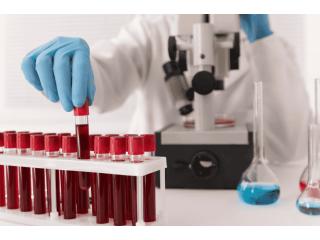 Total Ige Test in Delhi and Gurgaon