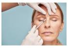 Dysport Injections Boca in Raton, FL - Get Naturally Smoother Skin - Dr. G Medspa