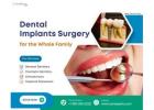 Who Is a Good Candidate for Dental Implants?