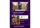 What Makes Alopecia Wigs in Bangalore So Popular? 
