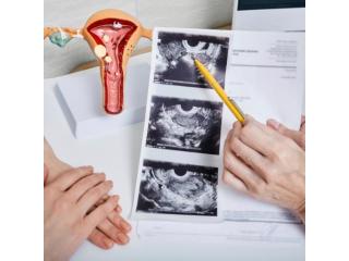 Gynecology Services in