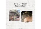 Dr Ditta Hair Transplants – Expert Hair Transplant for Women at Manchester