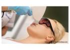 Experience Fast and Safe Laser Hair Removal in Riverside