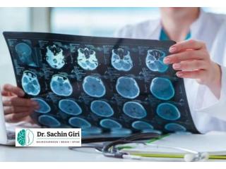 Brain Tumor Surgery in Mumbai by Dr.Sachin Giri