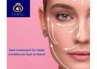 Advanced Anti-Aging & Deep Wrinkle Treatment in Thane – Only at DNA Royal.