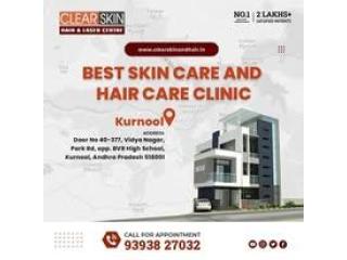 Pulse dye laser treatment in india