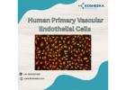 Precision in Primary Human Endothelial Cells Isolation