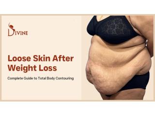 360° Body Contouring Removes Loose, Sagging Skin After Weight Loss At Divine