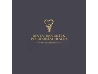 Dental Implants & Periodontal Health