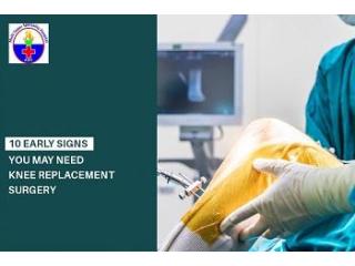 Looking for signs you may need knee replacement surgery