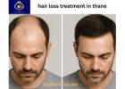 Best Hair Loss Treatment in Thane by DNA Royal Aesthetic Clinic.