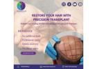 Premium Hair Transplant in Ahmedabad with Latest Technology