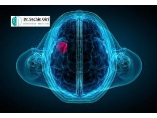 Advanced Brain Tumor Surgery in Mumbai by Dr. Sachin Giri