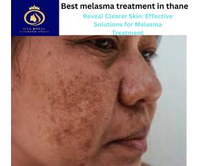 DNA Royal: Your Destination for the Best Melasma Treatment in Thane.
