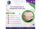 KosmoPlus – Leading Hospital for the Best Liposuction Surgery in Ahmedabad