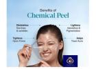 Advanced Chemical Face Peel in Thane – DNA Royal Aesthetic Clinic.