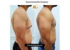 The OCCULT Technique for Gynecomastia