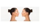 Rhinoplasty Surgery 101: What You Need to Know About Nose Reshaping