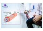 Best Doctor for Erectile Dysfunction in Bangalore - Orchidz Health