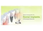 Comfortable Dental Implants in India
