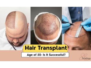 Hair Transplant in Gurgaon – Confidence You Can Trust