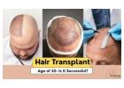 Hair Transplant in Gurgaon – Confidence You Can Trust