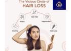 Hair Fall Treatment in Thane: Advanced Solutions at DNA Royal Aesthetic Clinic.