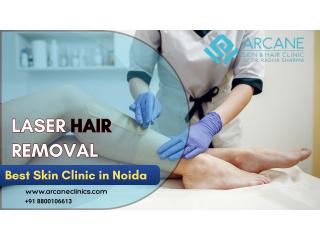 Laser Hair Removal for Indian Skin: Is It Safe?