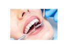 Professional Dental Implant Solutions in Bristol Restoring Smile
