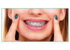 Smile Design Dental Clinic in Pune