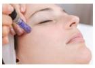 Microneedling Surrey BC – Smooth Skin