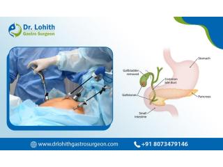 Advanced Laparoscopic Gall Bladder Surgery in Sarjapur Road - Dr. Lohith Gastrosurgeon