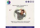 KosmoPlus – Advanced Hair Transplant in Ahmedabad for Permanent Results