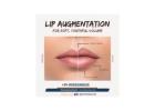 Get Fuller, Softer Lips with Expert Lip Augmentation!