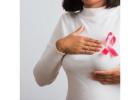 Best Breast Cancer Treatment in Ahmedabad Guided by Dr Mihir Shah