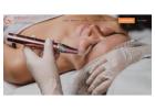 Micro Needling Treatment In Dubai