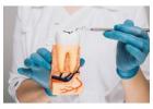 Painless Root Canal Treatment in Kurla