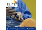 Best Knee Replacement Surgeon in Ahmedabad for Pain Relief – Elite Hospital