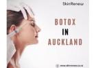 Flexible Botox Payment Plans in Auckland : Trusted Experts