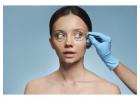 Baggy eyelid surgery in Lucknow