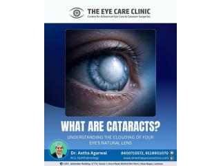 Cataract Surgery Cost in Lucknow - Visit The Eye Care Clinic