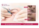 Best Mole Removal Treatment in Bangalore - Dr. Priya Skin and Hair Clinic