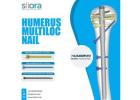 Advanced Stability for Humeral Fracture Care – Humerus Multiloc Nail