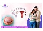 Affordable IVF Treatment Cost in Bangalore - Orchidz Health